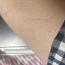 성모자이약국 | [ 투병일기 5 ] 서울성모 외래, 골수검사 어게인, 항암 휴식기 일상