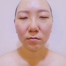 두리베어 | 군산윤곽관리 두리스킨케어 윤곽리프팅관리 후기