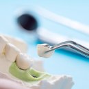 OK치과기공소 이미지