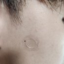 청수로 | 뾰루지 올라오면, 다이소 신박템. 마이크로니들 패치 (다이소 대형매장, 베스트 뷰티템 등)