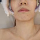 (유)삼정 | 부산 서면 더유에스테틱 윤곽관리 후기 — 신부관리·웨딩관리 찾는 분께도 추천!