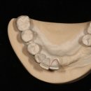 위드 치과기공소 이미지