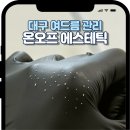 롯데마트대구점 LG화장품 | 대구 여드름 압출 잘하는곳 후기 온오프에스테틱 물방울 재생관리