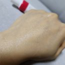 메디-1000(Medi-1000) 이미지