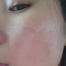 로덱스화장품울산총판 - 울주군 서상평길 19-10 | 로덱스 화장품 에뮤겔 내돈내산 가격 습진 여드름 아토피 탄력 주름