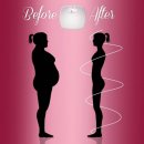 엘에스글로벌 이미지