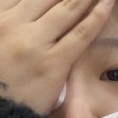 향남밝은안과의원 | [화성 향남 안과] 프로 다래끼러의 안아픈 안과추천!_향남밝은안과의원