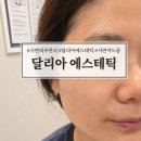 서면 피부관리 달리아에스테틱 맞춤피부관리 후기(압출, 고주파)