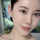 강남역 요정귀필러 재시술 내돈내산 후기 / 귀필러 통증, 부작용, 가격 누운귀 교정