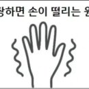 긴장하면 손이 떨리는 원인 이미지