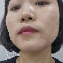 뷰티젠의원 이미지