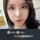 카라멜성형외과의원 네이버블로그