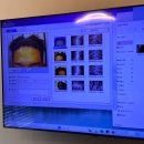 원명파크 | [탈모일기 #3] 탈모약 복용 1년 솔직 후기 | 대구 탈모성지 추천 | 비포에프터 비교사진 有