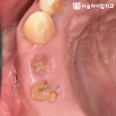 서울하이탑치과의원 이미지