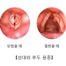 성대 이미지