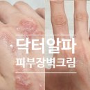 윤씨인공수정소 | 손등 습진 연고도 소용없던 만성 피부염 극복한 눈물 후기