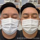 효성아파트건너편(18151) | 울산 매곡 남자눈썹문신 잘하는곳 꼼꼼한영이씨뷰티(가격)
