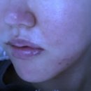 아하다스킨 이미지