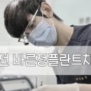 바른정플란트치과의원 네이버블로그