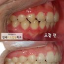연세미소담은치과 이미지