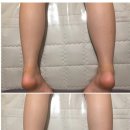 더맑은피부 - 동해시 천곡1길 9 | 더맑은피부