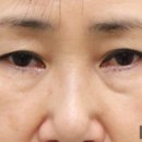 리미트성형외과의원 이미지