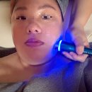 179 | 금천구 물방울초음파 잘하는곳 179에스테틱 피부관리 후기