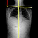 아람메디 이미지