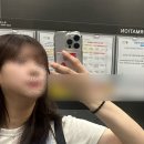 브이엘 | 강남지방파괴주사 후기, 브이엘주사 맞고 2주차부터 달라진 턱라인