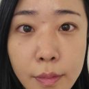 논현역피부관리 로지에스떼 , 세멘시트 후기