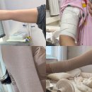 (주)지엠메디칼 | 강남 팔 지방흡입 후기 통증 에덴메디칼 압박복 당일부터 3일차까지