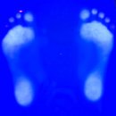 서짐 | 전주 체형교정 리바디앤뷰티｜예신 하체라인 관리, 발 아치부터 달라진 몸 밸런스 후기