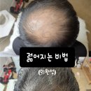 쏘스칼프