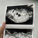 양남보건지소 이미지