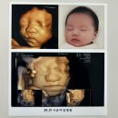 임신 32주차 일기 | 입체초음파 &amp; 베이비페이스, 태동검사, 양수 부족, 셀프 만삭사진 촬영
