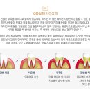최치과의원 | 광명동 치과? 이 부분들은 꼭 확인해보셨으면 좋겠습니다.