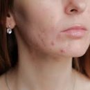 둔산한의원 이미지