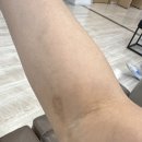 유방암 선행항암 8차 마무리 후기｜후련함과 감사, 부작용 최소화하며 지나온 시간 👍