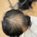 리셋헤어 이미지