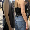 양이멍이 | 팔뚝지방흡입 가격 후기 내돈내산으로 경험한 회복기간과 흉터