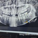 영통하나치과의원 이미지