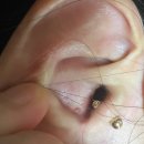 부안약국 | 부안 전원생활 중 화상 사고 + 귀 수포 통증 후기｜격포 국민약국 약국 후기·전원생활 응급약 준비 팁