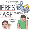 폴포이스안경 이미지