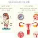 여자 아랫배 통증 이유 및 치료 진단 방법 알아봐요 이미지