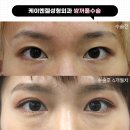 케이엔젤성형외과의원 이미지