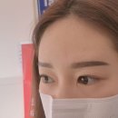 아장속눈썹