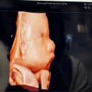 공공용 28 | [임신 28주-29주] 포천공공산후조리원 당첨, 입체초음파, 산후도우미 지정 사전예약 완료