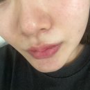 리뷰티제 | 덕계피부관리 :: 리뷰티제 문제성피부 미세약초 재생필 찐후기