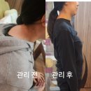 류스킨앤바디 | 전주바디관리 웨딩관리 류스킨앤바디 솔직후기 강력 추천!