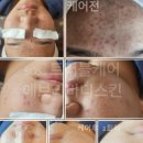 에브리바디스킨